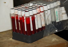 Bisher 4,8 Mio. Euro für den HCB-Fonds aufgewendet Für Blut- und Muttermilchuntersuchungen wurden bislang 213.000 Euro aufgewendet.