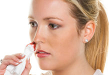 Es kommt oft plötzlich und unerwartet – Nasenbluten Die kleinen Blutgefäße in der Nase liegen sehr oberflächlich und sind stark durchblutet