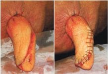 Wenn die ganze Kuh an einer Zitze hängt